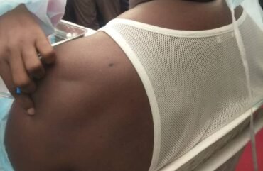 Covid-19 : 34 200 vaccins offerts à la région du Littoral