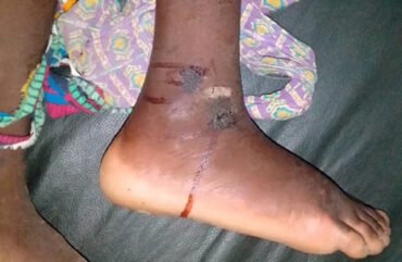 Faro : 269 personnes mordues par des serpents entre 2019 et 2022