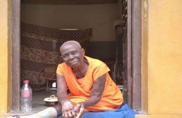 Extrême-Nord : 58 cas de lèpre enrôlés entre 2018 et 2023