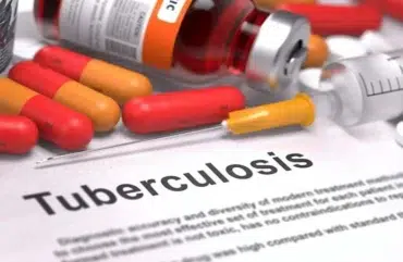 Tuberculose : Les antituberculeux en rupture pendant 24 semaines