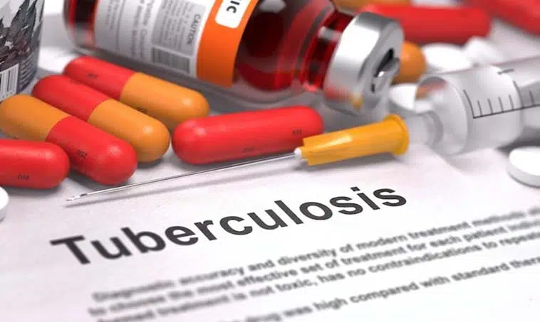 Tuberculose : Les antituberculeux en rupture pendant 24 semaines
