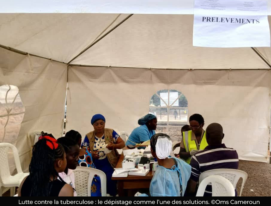 Tuberculose : Le Cameroun enregistre une hausse de plus de mille cas en un an