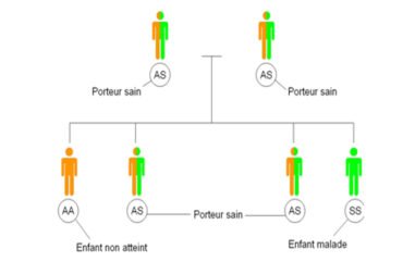 Drépanocytose : le nombre de décès triple au Cameroun entre 2023 et 2024