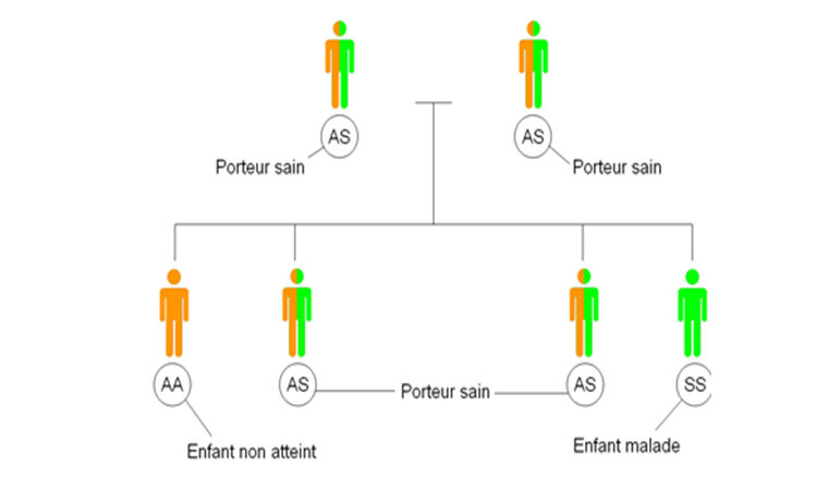 Drépanocytose : le nombre de décès triple au Cameroun entre 2023 et 2024