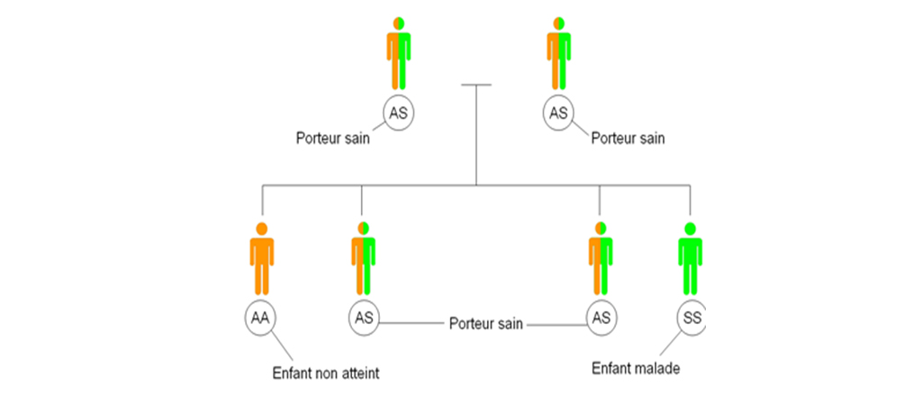 Drépanocytose : le nombre de décès triple au Cameroun entre 2023 et 2024