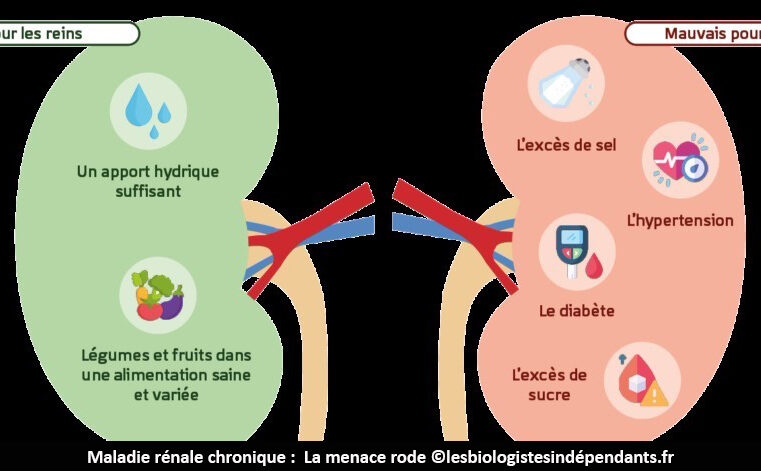 Maladie rénale chronique : La menace persiste au Cameroun
