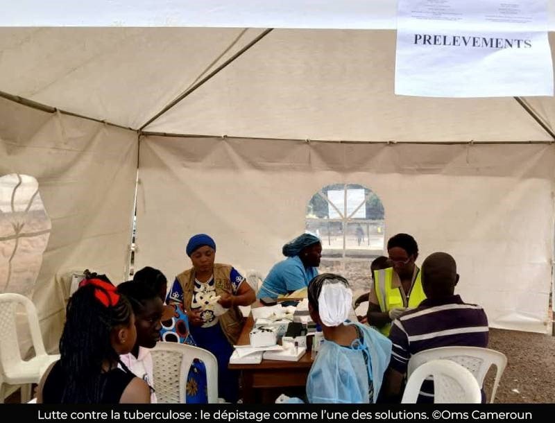 Tuberculose : une baisse d’environ 1% enregistré en 2025 au Cameroun