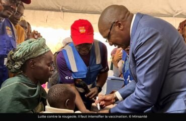Rougeole au Cameroun : hausse des cas de 183 % en 2025 après l’accalmie de 2024